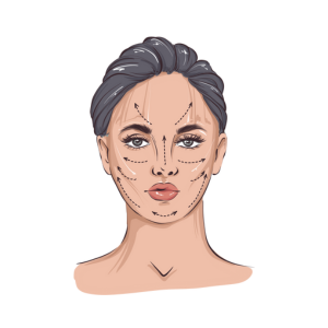 Plastic Surgeon