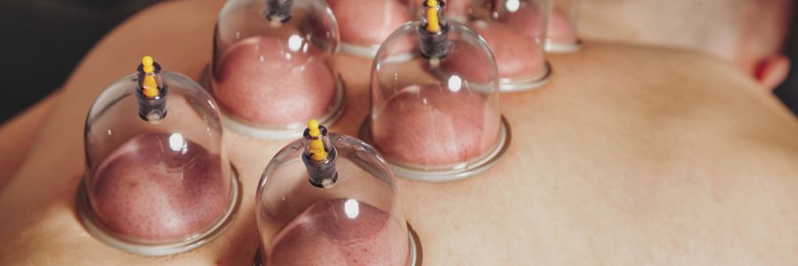 Cupping